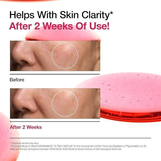 Anua Niacinamide 10 & TXA 4 Serum (30ml)