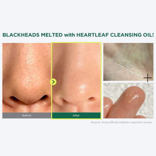 Anua - Heartleaf Pore Control Cleansing Oil Mini (20ml)